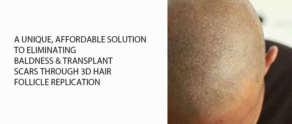 Before and after scalp micropigmentation result